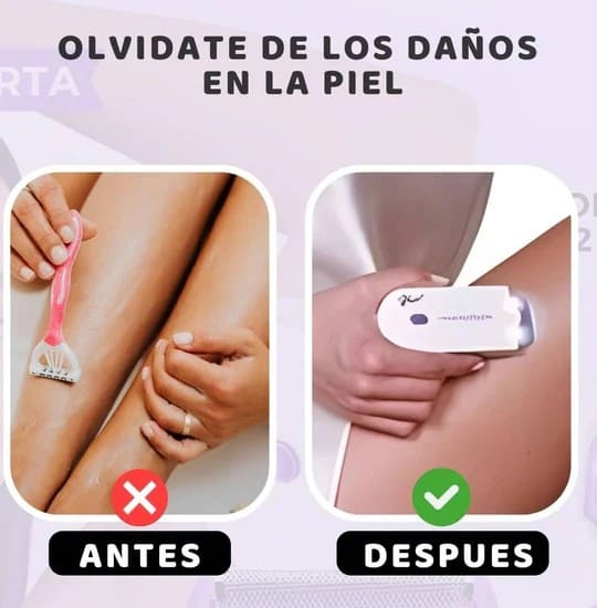 Depiladora Anti-Irritación: Adiós Cortes, Tirones y Ardor